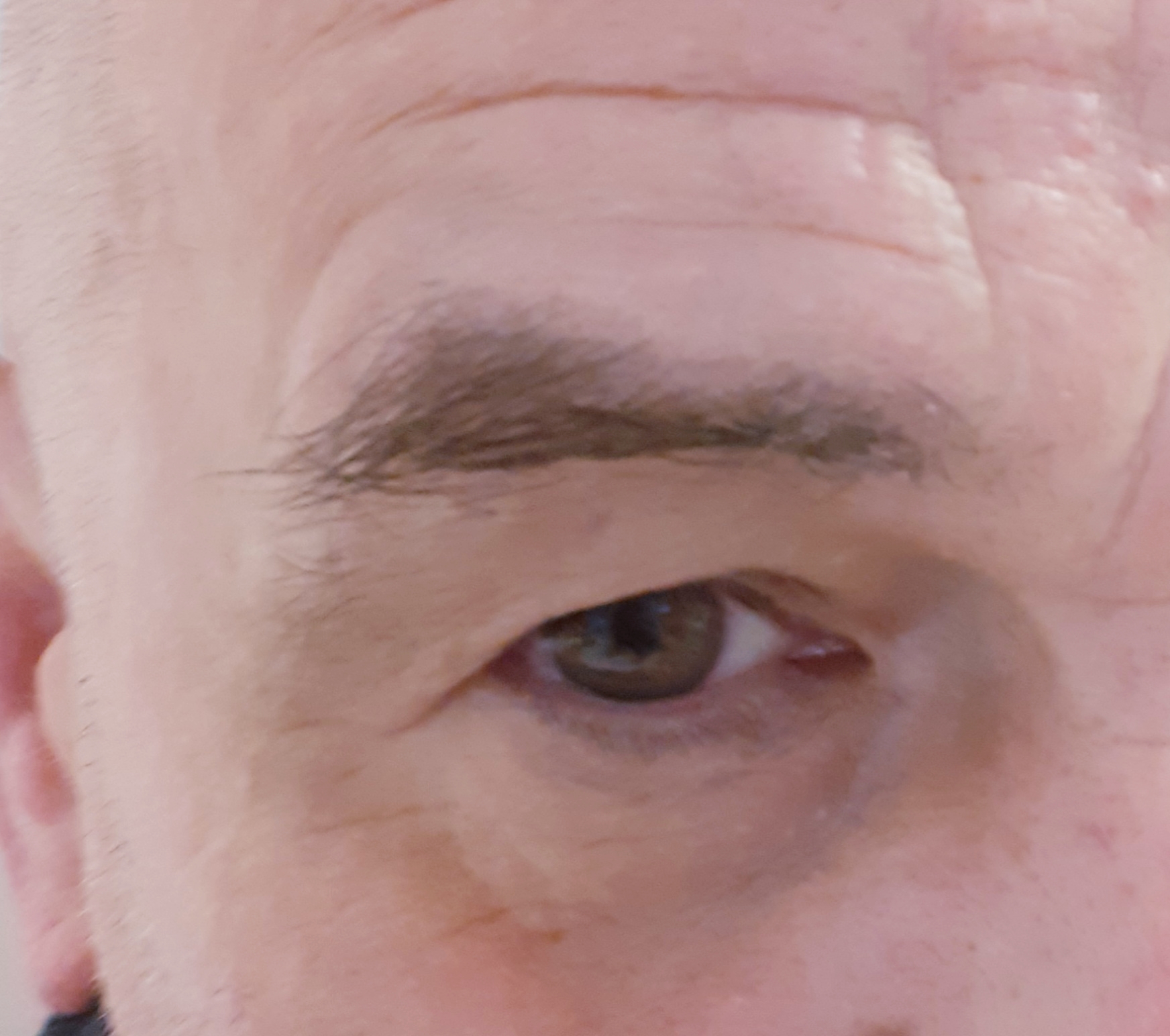 Před zákrokem